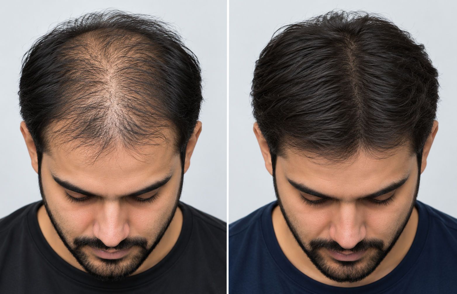 GFC therapy result after six sessions