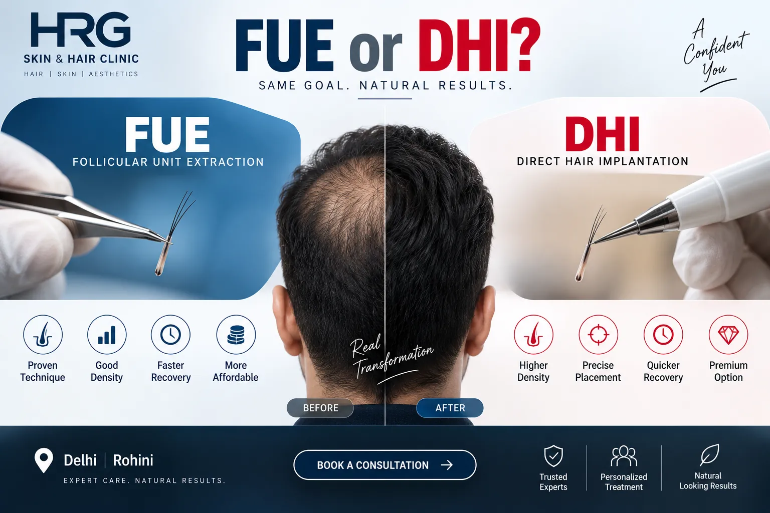 FUE and DHI hair transplant comparison at HRG Clinic